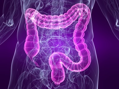 Irritable Bowel Syndrome